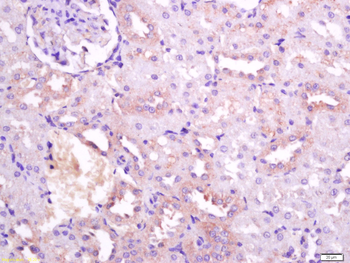 FHOD3 Rabbit Polyclonal Antibody