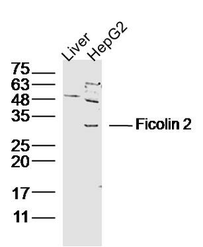 Ficolin 2 Rabbit Polyclonal Antibody