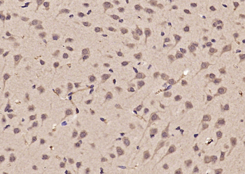 FIG4 Rabbit Polyclonal Antibody
