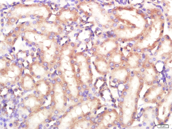 FKBP10 Rabbit Polyclonal Antibody