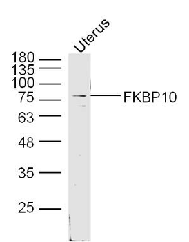 FKBP10 Rabbit Polyclonal Antibody