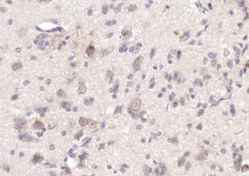 FLRT2 Rabbit Polyclonal Antibody