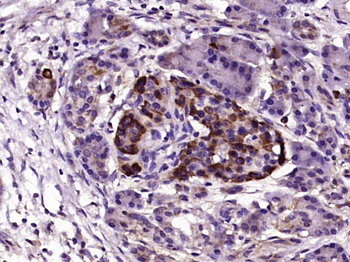 FLVCR Rabbit Polyclonal Antibody