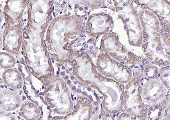 FLVCR Rabbit Polyclonal Antibody