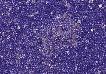 FLVCR Rabbit Polyclonal Antibody