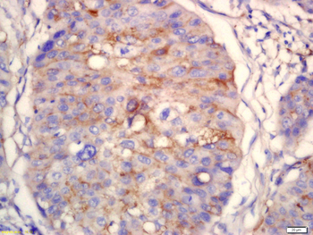 FMO5 Rabbit Polyclonal Antibody