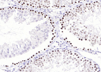 Phospho-FMRP (Ser500) Rabbit Polyclonal Antibody
