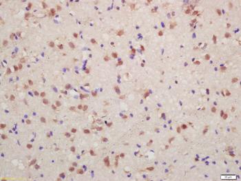Phospho-FMRP (Ser500) Rabbit Polyclonal Antibody
