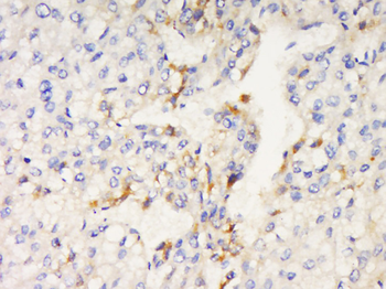 FNBP1L Rabbit Polyclonal Antibody