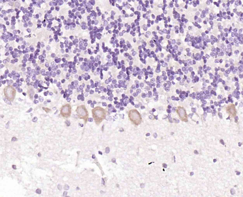 Folate Receptor 4 Rabbit Polyclonal Antibody
