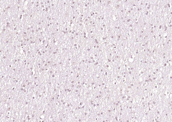 FOXD3 Rabbit Polyclonal Antibody