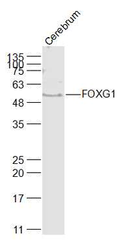 FOXG1 Rabbit Polyclonal Antibody