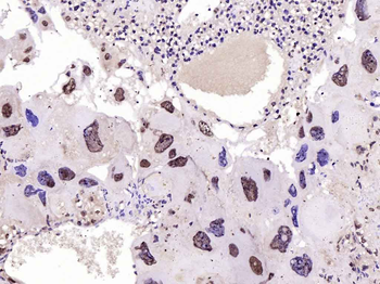 Phospho-FoxO1 (Ser329) Rabbit Polyclonal Antibody