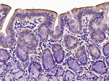 Phospho-FoxO1 (Ser329) Rabbit Polyclonal Antibody