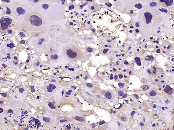 Phospho-FoxO1 (Ser329) Rabbit Polyclonal Antibody