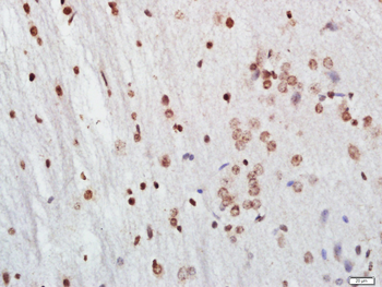 FOXP3 Rabbit Polyclonal Antibody