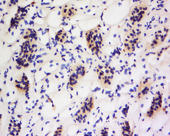FOXRED2 Rabbit Polyclonal Antibody