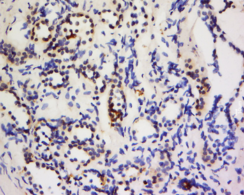 FOXRED2 Rabbit Polyclonal Antibody