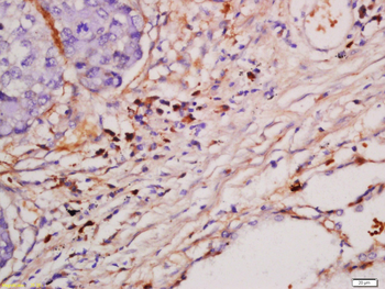 Frizzled 10/CD350 Rabbit Polyclonal Antibody