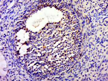 FTS Rabbit Polyclonal Antibody