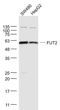 FUT2 Rabbit Polyclonal Antibody