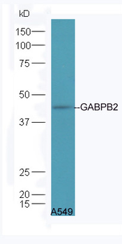 GABPB2 Rabbit Polyclonal Antibody