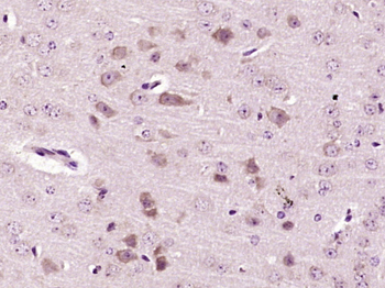 GABRB2 Rabbit Polyclonal Antibody