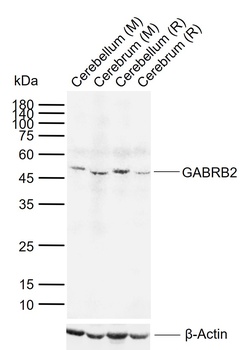 GABRB2 antibody