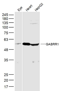 GABRR1 Rabbit Polyclonal Antibody