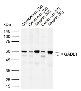 GADL1 Rabbit Polyclonal Antibody