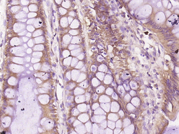 Galectin 10 Rabbit Polyclonal Antibody