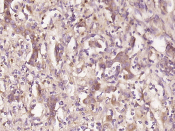 Galectin 10 Rabbit Polyclonal Antibody