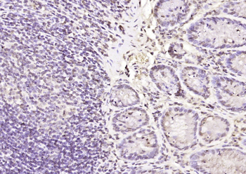 Galectin 3 Rabbit Polyclonal Antibody