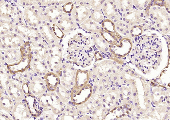GALK2 Rabbit Polyclonal Antibody
