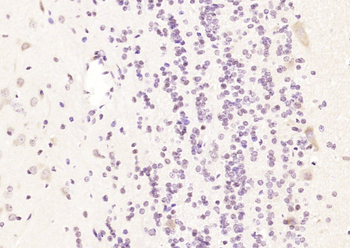 GALM Rabbit Polyclonal Antibody