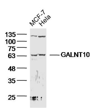 GALNT10 Rabbit Polyclonal Antibody