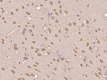 GALNT11 Rabbit Polyclonal Antibody
