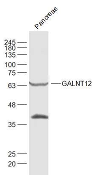 GALNT12 Rabbit Polyclonal Antibody