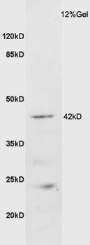 GALR2 Rabbit Polyclonal Antibody