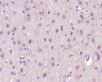 GAMT Rabbit Polyclonal Antibody