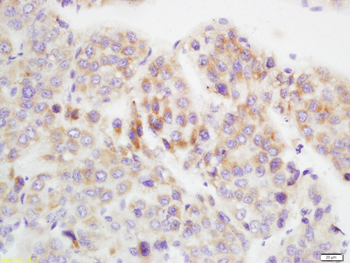 GAMT Rabbit Polyclonal Antibody