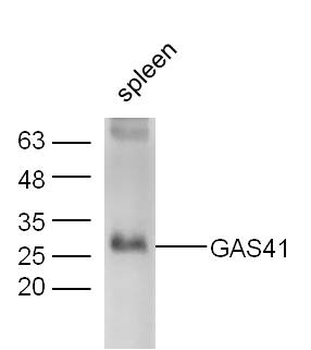 GAS41 Rabbit Polyclonal Antibody