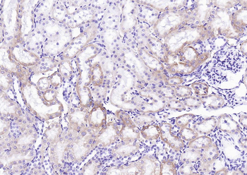 GBA3 Rabbit Polyclonal Antibody