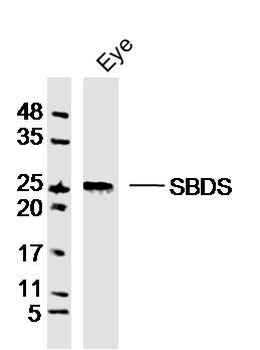 GCAP1 Rabbit Polyclonal Antibody