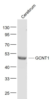 GCNT1 Rabbit Polyclonal Antibody
