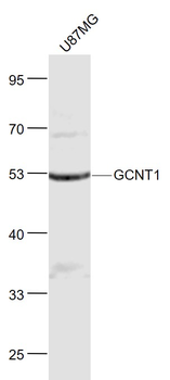 GCNT1 Rabbit Polyclonal Antibody