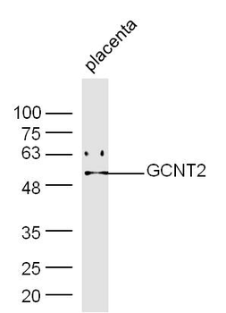 GCNT2 Rabbit Polyclonal Antibody