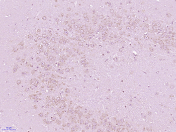 GCP6 Rabbit Polyclonal Antibody