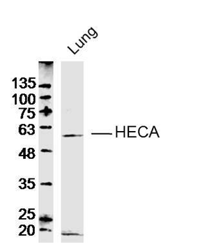 HECA Rabbit Polyclonal Antibody