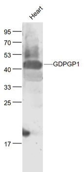 GDPGP1 Rabbit Polyclonal Antibody